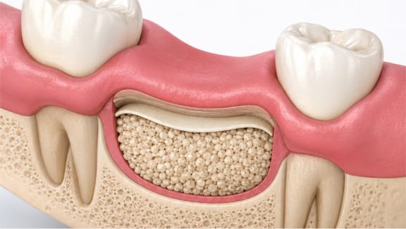 A clinician reviewing 3D imaging of jawbone volume before implant planning