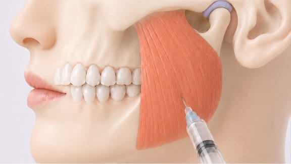 A clinician reviewing jaw muscle tension with a patient before treatment