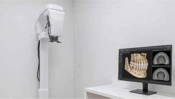 Cone beam CT scanner for 3D dental imaging