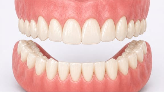 A natural-looking custom denture crafted at Tomlinson Dental in Tampa