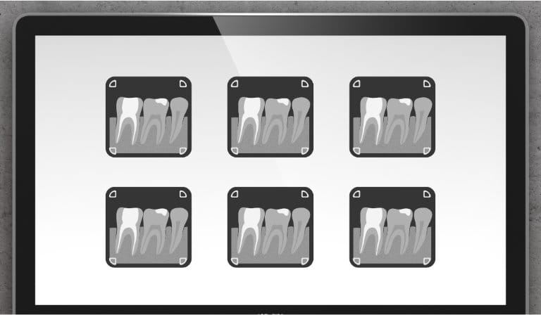 Digital X-Rays