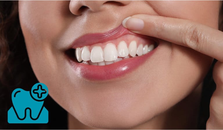 Healthy Gums